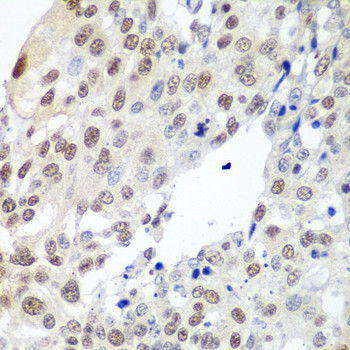 Securin Antibody in Immunohistochemistry (Paraffin) (IHC (P))