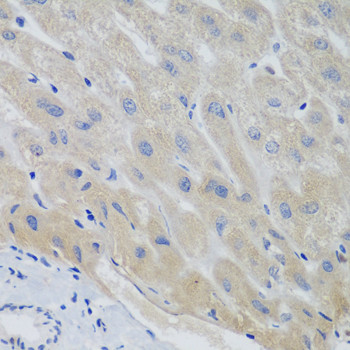 Securin Antibody in Immunohistochemistry (Paraffin) (IHC (P))