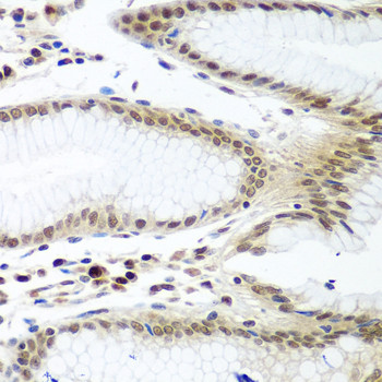 Securin Antibody in Immunohistochemistry (Paraffin) (IHC (P))