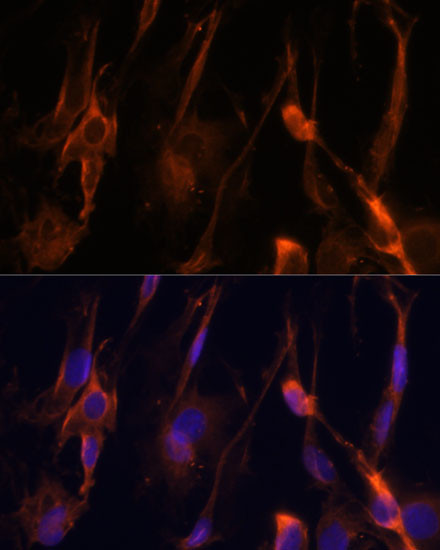 BFAR Antibody in Immunocytochemistry (ICC/IF)