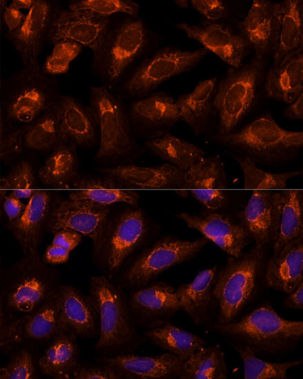 BFAR Antibody in Immunocytochemistry (ICC/IF)