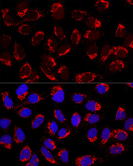 AP1M2 Antibody in Immunocytochemistry (ICC/IF)