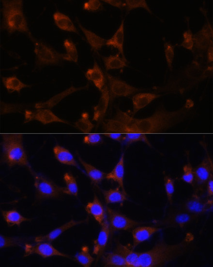 CAD Antibody in Immunocytochemistry (ICC/IF)