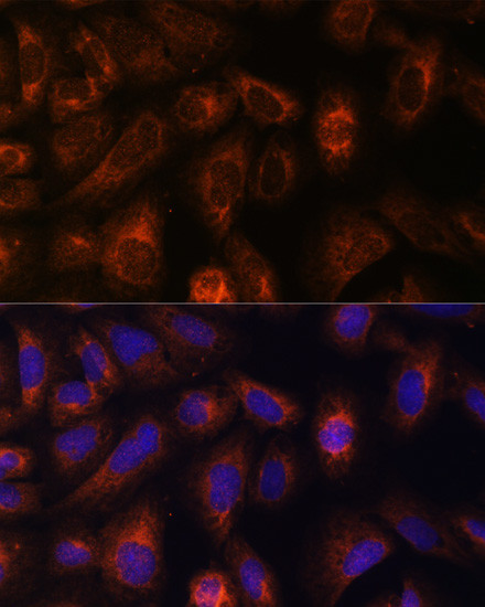 CAD Antibody in Immunocytochemistry (ICC/IF)