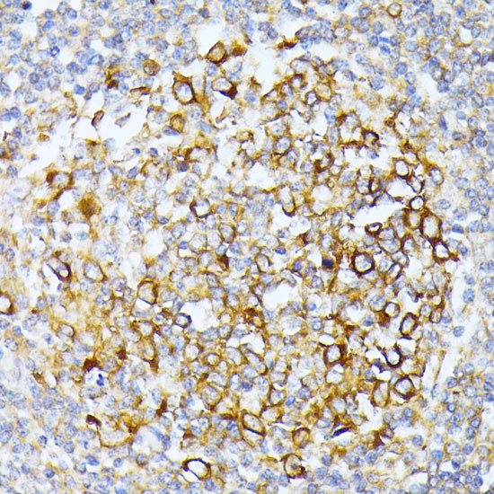 CAD Antibody in Immunohistochemistry (Paraffin) (IHC (P))