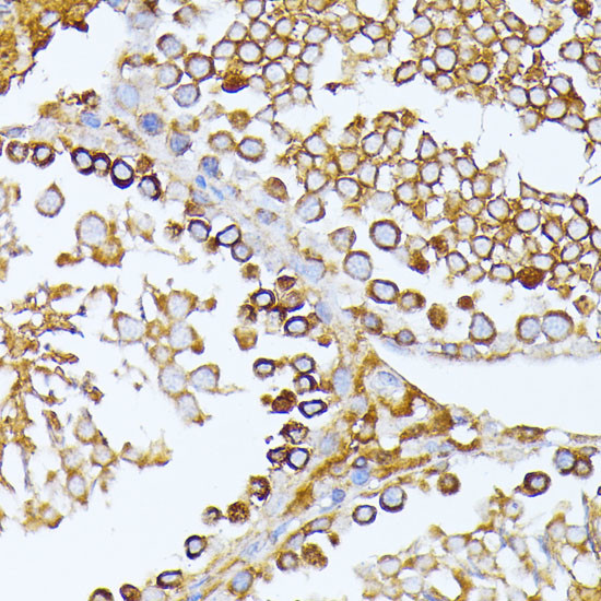 CAD Antibody in Immunohistochemistry (Paraffin) (IHC (P))