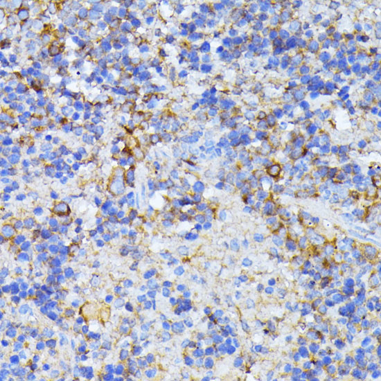 CAD Antibody in Immunohistochemistry (Paraffin) (IHC (P))