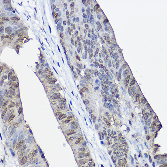 XPC Antibody in Immunohistochemistry (Paraffin) (IHC (P))