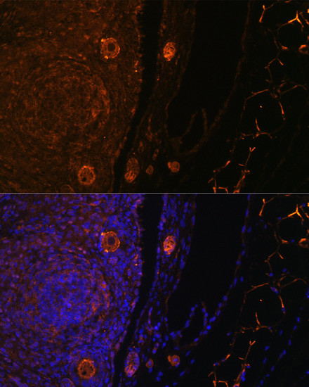 ZP3 Antibody in Immunocytochemistry (ICC/IF)