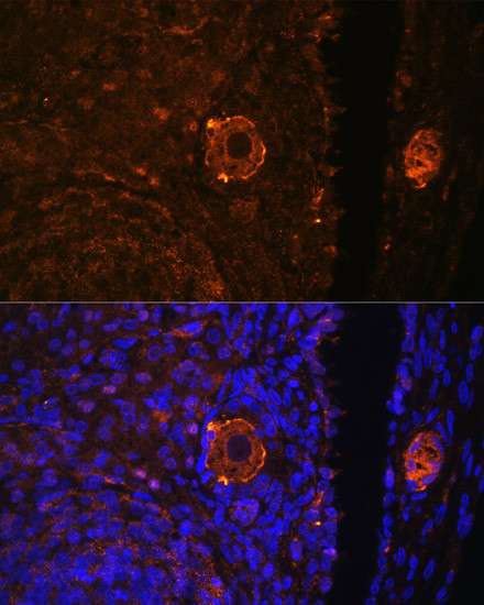 ZP3 Antibody in Immunocytochemistry (ICC/IF)