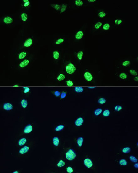 UAP56 Antibody in Immunocytochemistry (ICC/IF)