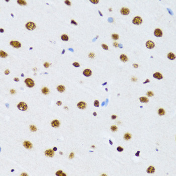 UAP56 Antibody in Immunohistochemistry (Paraffin) (IHC (P))