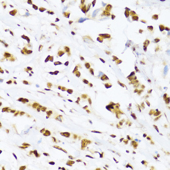 UAP56 Antibody in Immunohistochemistry (Paraffin) (IHC (P))