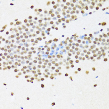 UAP56 Antibody in Immunohistochemistry (Paraffin) (IHC (P))