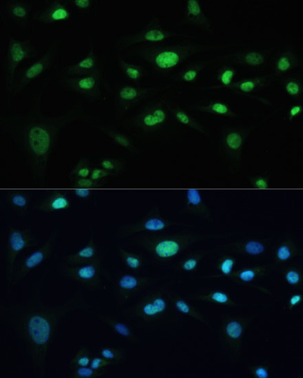 MDC1 Antibody in Immunocytochemistry (ICC/IF)