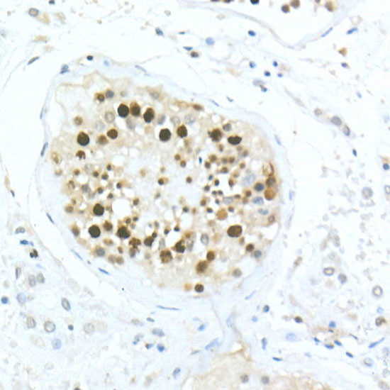 MDC1 Antibody in Immunohistochemistry (Paraffin) (IHC (P))