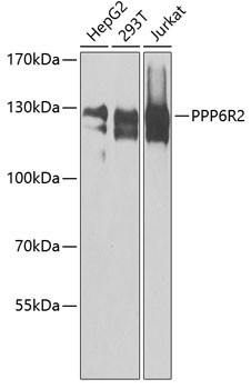 SAPS2 Antibody in Western Blot (WB)