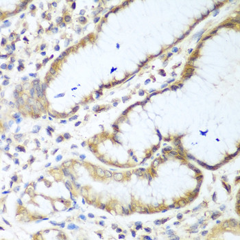 NUDT15 Antibody in Immunohistochemistry (Paraffin) (IHC (P))