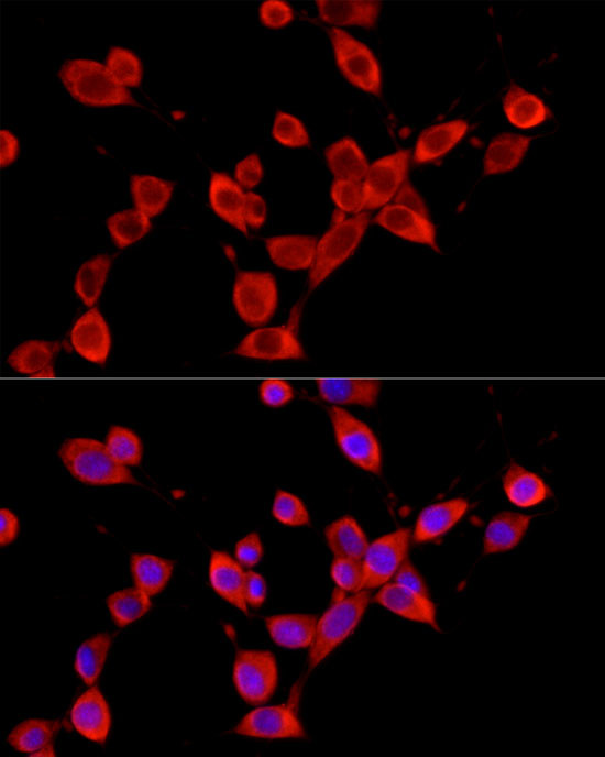 YTHDF3 Antibody in Immunocytochemistry (ICC/IF)