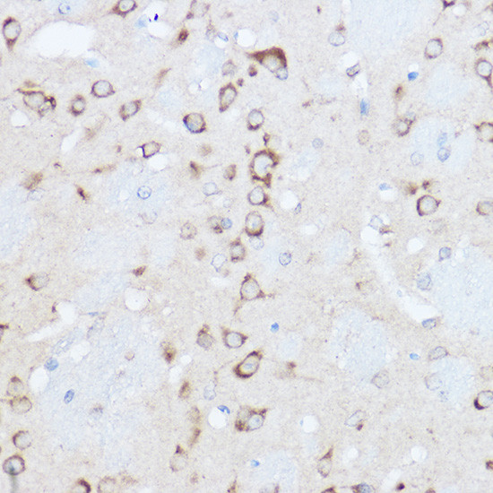 YTHDF3 Antibody in Immunohistochemistry (Paraffin) (IHC (P))