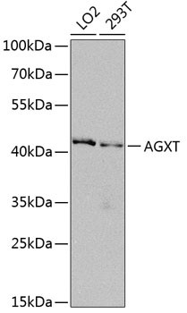 AGXT Antibody in Western Blot (WB)