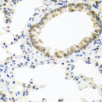 BMP5 Antibody in Immunohistochemistry (Paraffin) (IHC (P))