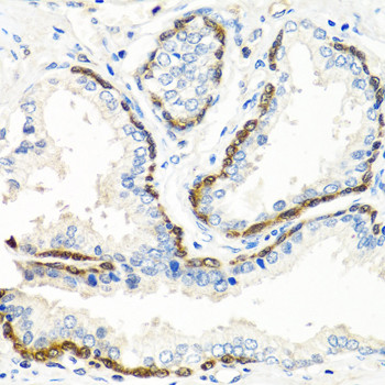 BMP5 Antibody in Immunohistochemistry (Paraffin) (IHC (P))