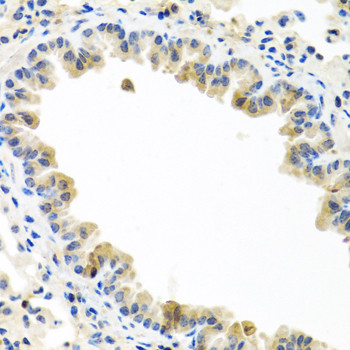 BMP5 Antibody in Immunohistochemistry (Paraffin) (IHC (P))