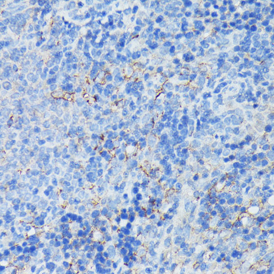 CD21 Antibody in Immunohistochemistry (Paraffin) (IHC (P))