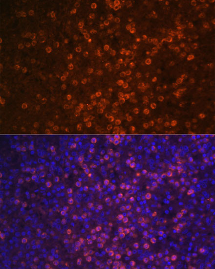 CD21 Antibody in Immunohistochemistry (Paraffin) (IHC (P))