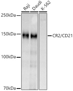 CD21 Antibody in Western Blot (WB)