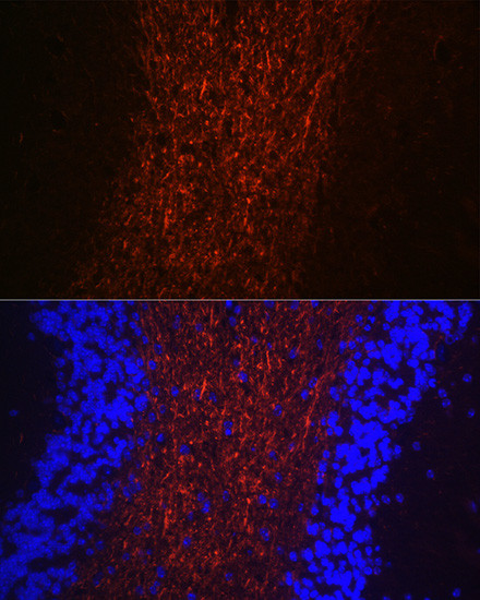 NF-H Antibody in Immunohistochemistry (Paraffin) (IHC (P))