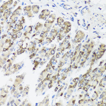 TIMM10B Antibody in Immunohistochemistry (Paraffin) (IHC (P))