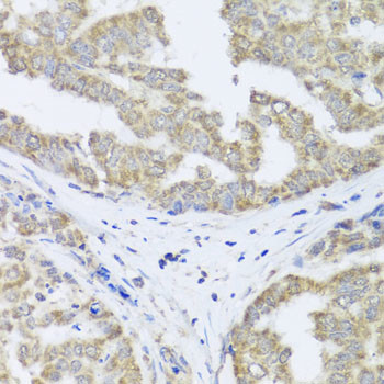 TIMM10B Antibody in Immunohistochemistry (Paraffin) (IHC (P))