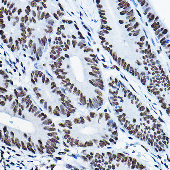 MKL1 Antibody in Immunohistochemistry (Paraffin) (IHC (P))