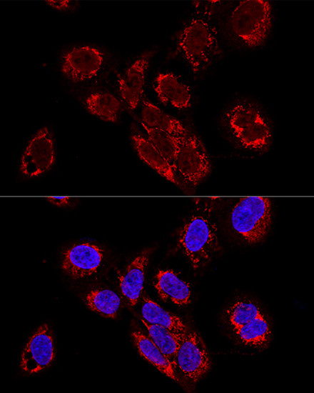 TEFM Antibody in Immunocytochemistry (ICC/IF)