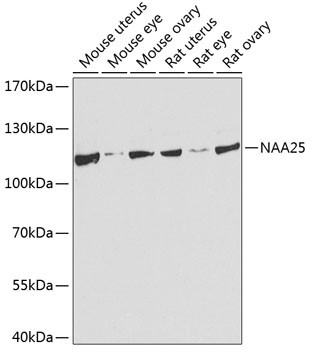 C12orf30 Antibody in Western Blot (WB)