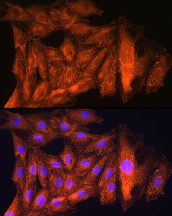 CKAP5 Antibody in Immunocytochemistry (ICC/IF)