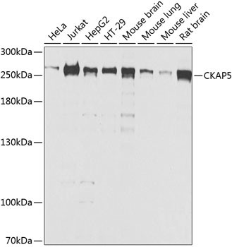 CKAP5 Antibody in Western Blot (WB)