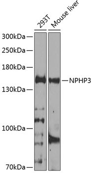 NPHP3 Antibody in Western Blot (WB)