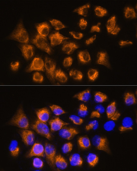 beta-3 Adrenergic Receptor Antibody in Immunocytochemistry (ICC/IF)