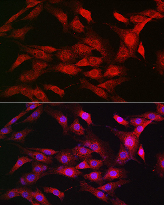 Importin beta-1 Antibody in Immunocytochemistry (ICC/IF)