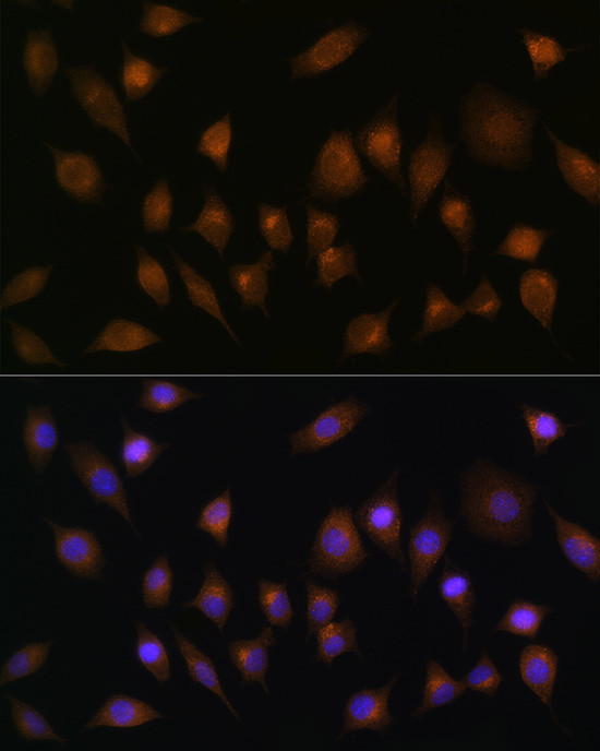 SNX1 Antibody in Immunocytochemistry (ICC/IF)