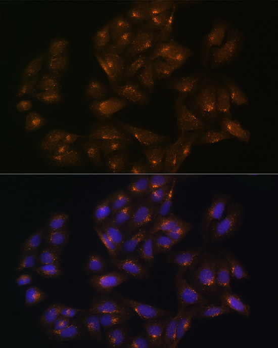 SNX1 Antibody in Immunocytochemistry (ICC/IF)