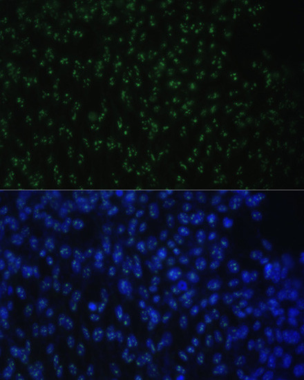 DDX50 Antibody in Immunocytochemistry (ICC/IF)