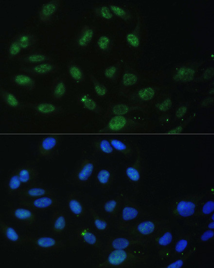 DDX50 Antibody in Immunocytochemistry (ICC/IF)