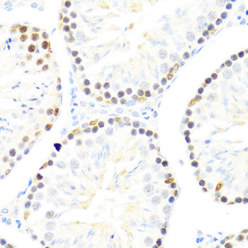 DDX50 Antibody in Immunohistochemistry (Paraffin) (IHC (P))