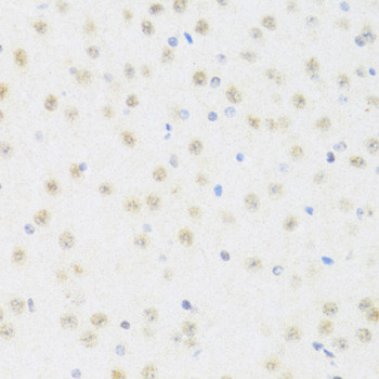 DDX50 Antibody in Immunohistochemistry (Paraffin) (IHC (P))