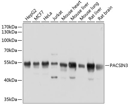 PACSIN3 Antibody in Western Blot (WB)