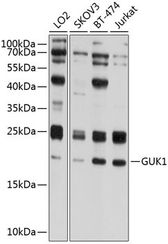 GUK1 Antibody in Western Blot (WB)